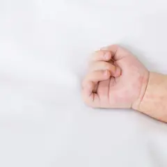 Różowa wysypka u dziecka na białym tle. Skóra na rączce jest zaczerwieniona i pokryta drobnymi plamkami.